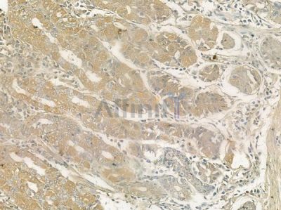 MLANA Antibody - AF0204 at 1/100 staining human normal gastric tissue by IHC-P.
