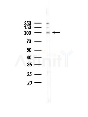MCM5 Antibody - Western blot analysis of lysates from COLO205 cells(UV,30min treatment), using MCM5 Antibody at 1/1000 dilution.