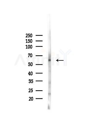 MMP11 Antibody - Western blot analysis of lysates from PC12 cells(LPS, 4h treatment), using MMP11 Antibody at 1/1000 dilution.