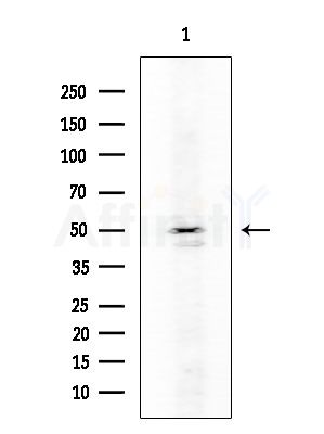 MMP14 Antibody - Western blot analysis of extracts from COLO205 cells, using MMP14 Antibody at 1/1000 dilution.