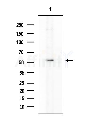 MMP14 Antibody - Western blot analysis of extracts from Rat testis, using MMP14 Antibody at 1/1000 dilution.