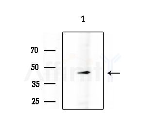 MMP8 Antibody - Western blot analysis of extracts from COLO205 cells, using MMP8 Antibody at 1/1000 dilution.