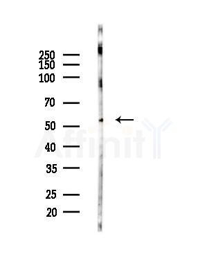 MMP8 Antibody - Western blot analysis of lysates from COLO205 cells, using MMP8 Antibody at 1/1000 dilution.