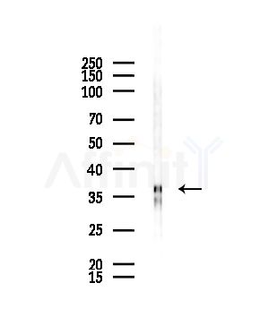 NKX3.1 Antibody - Western blot analysis of lysates from HepG2 cells(starvation,24h treatment), using NKX3.