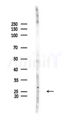 NM23 Antibody - Western blot analysis of lysates from Rat brain, using NM23 Antibody at 1/1000 dilution.
