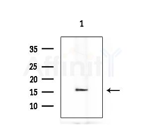 CDKN2A/p16INK4a Antibody - Western blot analysis of extracts from Mouse brain, using CDKN2A/p16INK4a Antibody at 1/1000 dilution.