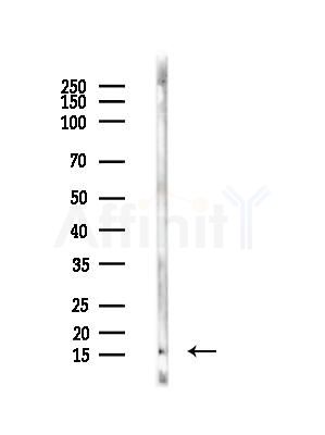 CDKN2A/p16INK4a Antibody - Western blot analysis of lysates from Mouse brain, using CDKN2A/p16INK4a Antibody at 1/1000 dilution.