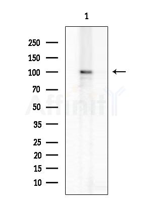 PCAF Antibody - Western blot analysis of extracts from COLO205 cells, using PCAF Antibody at 1/1000 dilution.