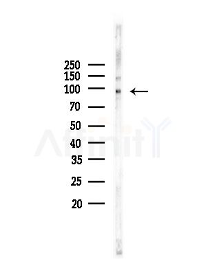 PCAF Antibody - Western blot analysis of lysates from COLO205 cells, using PCAF Antibody at 1/1000 dilution.