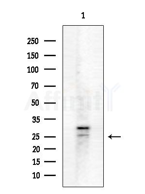 Parathyroid Hormone Antibody - Western blot analysis of extracts from COLO205 cells, using Parathyroid Hormone Antibody at 1/1000 dilution.