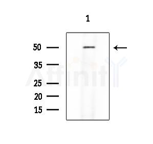 Parkin Antibody - Western blot analysis of extracts from COLO205 cells, using Parkin Antibody at 1/1000 dilution.