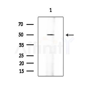 Parkin Antibody - Western blot analysis of extracts from HUVEC cells, using Parkin Antibody at 1/1000 dilution.