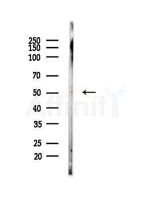 Parkin Antibody - Western blot analysis of lysates from HUVEC cells, using Parkin Antibody at 1/1000 dilution.