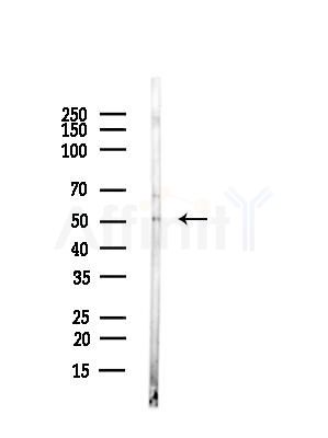 Parkin Antibody - Western blot analysis of lysates from COLO205 cells, using Parkin Antibody at 1/1000 dilution.