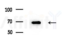 Cyclin L1 Antibody - Western blot analysis of extracts from A375 cells(heat-shock treatment), using Cyclin L1 Antibody at 1/1000 dilution.