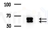 Cyclin L1 Antibody - Western blot analysis of extracts from COLO205 cells(heat-shock treatment), using Cyclin L1 Antibody at 1/1000 dilution.