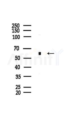 Cyclin L1 Antibody - Western blot analysis of lysates from COLO205 cells(heat-shock,45min treatment), using Cyclin L1 Antibody at 1/1000 dilution.