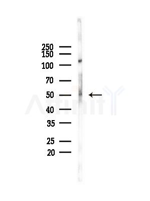 Peripherin Antibody - Western blot analysis of lysates from Rat lung, using Peripherin Antibody at 1/1000 dilution.