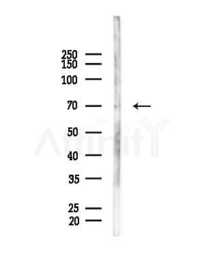 KCNC2 Antibody - Western blot analysis of lysates from A375 cells(heat-shock,45min treatment), using KCNC2 Antibody at 1/1000 dilution.