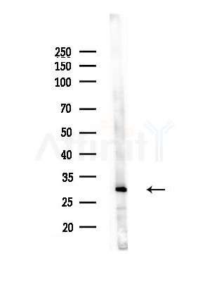 RASH/RASK/RASN Antibody - Western blot analysis of lysates from LoVo cells(heat-shock, 45min treatment), using RASH/RASK/RASN Antibody at 1/1000 dilution.