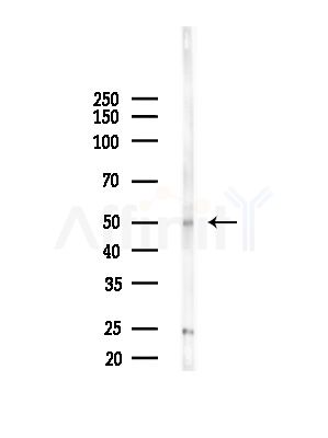 RCBTB1 Antibody - Western blot analysis of lysates from Mouse liver, using RCBTB1 Antibody at 1/1000 dilution.