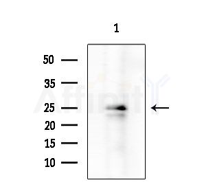 RIT1 Antibody - Western blot analysis of extracts from HUVEC cells, using RIT1 Antibody at 1/1000 dilution.