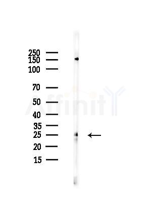 RIT1 Antibody - Western blot analysis of lysates from HUVEC cells, using RIT1 Antibody at 1/1000 dilution.