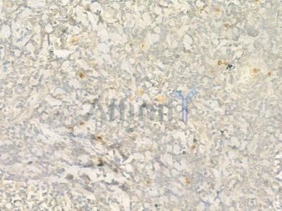 pan Sodium Channel Antibody - AF0255 at 1/100 staining human normal tonsil tissue by IHC-P.