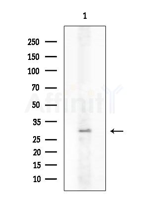 gamma Synuclein Antibody - Western blot analysis of lysates from COLO205 cells, using gamma Synuclein Antibody at 1/1000 dilution.