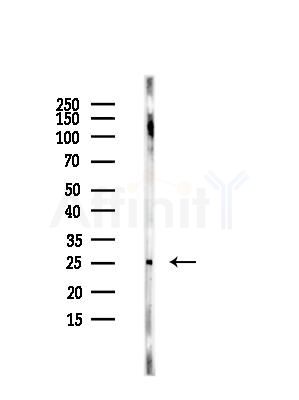 TIMP3 Antibody - Western blot analysis of lysates from HUVEC cells, using TIMP3 Antibody at 1/1000 dilution.