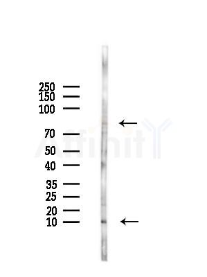 NEDD8 Antibody - Western blot analysis of lysates from HepG2 cells(LPS,4h treatment), using NEDD8 Antibody at 1/1000 dilution.