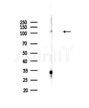 SENP7 Antibody - Western blot analysis of lysates from HepG2 cells(LPS,4h treatment), using SENP7 Antibody at 1/1000 dilution.