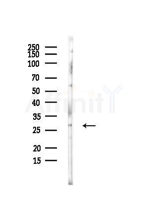 SENP8 Antibody - Western blot analysis of lysates from HUVEC cells, using SENP8 Antibody at 1/1000 dilution.