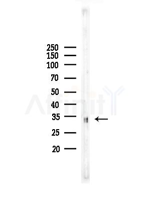 TRADD Antibody - Western blot analysis of lysates from COLO205 cells, using TRADD Antibody at 1/1000 dilution.