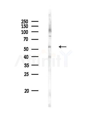 Tubulin gamma Antibody - Western blot analysis of lysates from Rat liver, using Tubulin gamma Antibody at 1/1000 dilution.