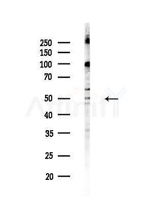 Tubulin gamma Antibody - Western blot analysis of lysates from EC304 cells(heat-shock treatment), using Tubulin gamma Antibody at 1/1000 dilution.
