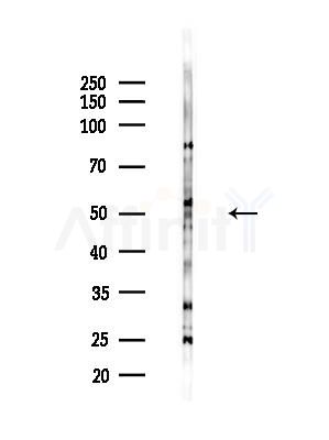 Tubulin gamma Antibody - Western blot analysis of lysates from B16F10-LUC cells(LPS,4h treatment), using Tubulin gamma Antibody at 1/1000 dilution.