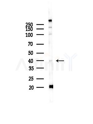 USF2 Antibody - Western blot analysis of lysates from COLO205 cells(UV,30min treatment), using USF2 Antibody at 1/1000 dilution.