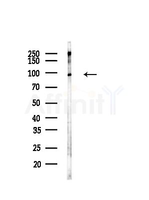 XRCC1 Antibody - Western blot analysis of lysates from COLO205 cells(heat-shock,45min treatment), using XRCC1 Antibody at 1/1000 dilution.