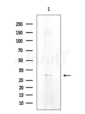 NKX6.3 Antibody - Western blot analysis of extracts from COLO205 cells, using NKX6.