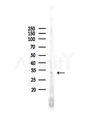 NKX6.3 Antibody - Western blot analysis of lysates from COLO205 cells, using NKX6.