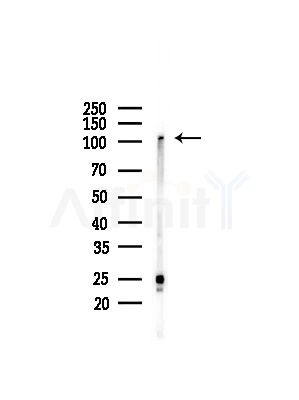 TAF4 Antibody - Western blot analysis of lysates from LoVo cells(heat-shock,45min treatment), using TAF4 Antibody at 1/1000 dilution.