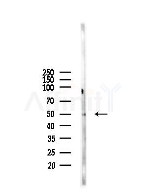 TRIM38 Antibody - Western blot analysis of lysates from A375 cells(starvation,24h treatment), using TRIM38 Antibody at 1/1000 dilution.