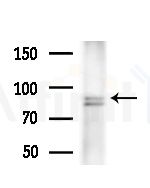 DLGAP1 Antibody - Western blot analysis of extracts from PC12 cells(LPS,4h treatment), using DLGAP1 Antibody at 1/1000 dilution.