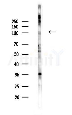 DLGAP1 Antibody - Western blot analysis of lysates from PC12 cells(LPS,4h treatment), using DLGAP1 Antibody at 1/1000 dilution.