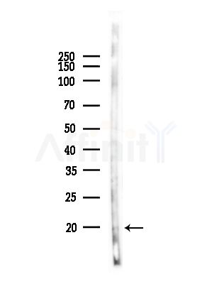 TP53I11 Antibody - Western blot analysis of lysates from PC12 cells, using TP53I11 Antibody at 1/1000 dilution.