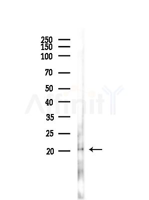 TP53I11 Antibody - Western blot analysis of lysates from Hela cells(heat-shock,45min treatment), using TP53I11 Antibody at 1/1000 dilution.