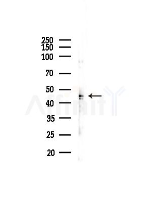 BCKD Antibody - Western blot analysis of lysates from Hela cells(heat-shock,45min treatment), using BCKD Antibody at 1/1000 dilution.