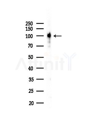 HGS Antibody - Western blot analysis of lysates from Hela cells(starvation,24h treatment), using HGS Antibody at 1/1000 dilution.