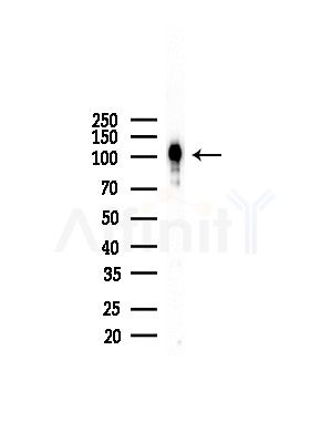 HGS Antibody - Western blot analysis of lysates from LoVo cells(heat-shock,45min treatment), using HGS Antibody at 1/1000 dilution.